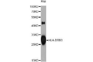 Western blot analysis of extracts of Raji cells, using HLA-DRB3 antibody (ABIN1873032) at 1:1000 dilution. (HLA-DRB3 抗体)