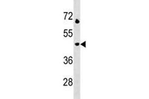 LAMP3 antibody western blot analysis in Jurkat lysate. (LAMP3 抗体  (AA 8-38))