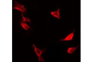 Immunofluorescence (fixed cells) (IF/ICC) image for anti-Protein tyrosine Phosphatase, Non-Receptor Type 1 (PTPN1) (pSer50) antibody (ABIN6256357)