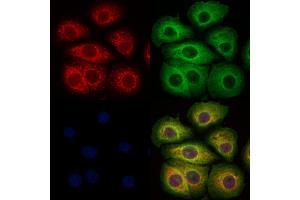 ABIN6265508 and ABIN6273329 staining Hela cells by IF/ICC.
