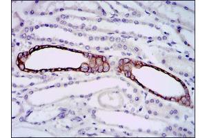 Immunohistochemical analysis of paraffin-embedded kidney tissues using mouse Splunc2 mouse mAb with DAB staining.