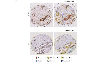 Immunohistochemistry (IHC) image for anti-Deoxycytidine Kinase (DCK) antibody (ABIN2855484)