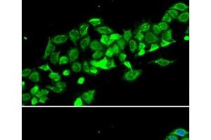 Immunofluorescence analysis of MCF-7 cells using RASSF1 Polyclonal Antibody (RASSF1 抗体)