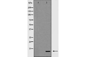 Western blot analysis on 293 cell lysate using Insulin Antibody,The lane on the left is treated with the antigen-specific peptide. (Insulin 抗体)