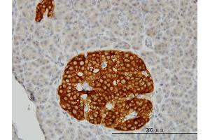 Immunoperoxidase of monoclonal antibody to RAB3B on formalin-fixed paraffin-embedded human pancreas. (RAB3B 抗体  (AA 120-219))