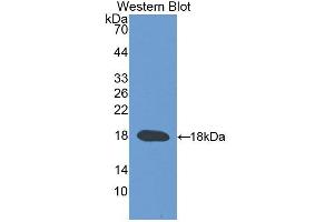 Detection of Recombinant TRPV3, Human using Polyclonal Antibody to Transient Receptor Potential Cation Channel Subfamily V, Member 3 (TRPV3)