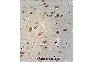 Immunohistochemistry (Paraffin-embedded Sections) (IHC (p)) image for anti-WD Repeat Containing Planar Cell Polarity Effector (WDPCP) (AA 676-705), (C-Term) antibody (ABIN654738)