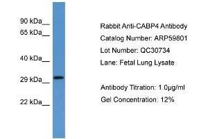 WB Suggested Anti-CABP4  Antibody Titration: 0. (CABP4 抗体  (N-Term))