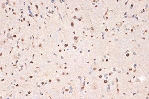 Immunohistochemistry of paraffin-embedded mouse spinal cord using DDX17 Rabbit mAb (ABIN7266688) at dilution of 1:100 (40x lens). (DDX17 抗体)