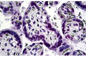 Human Placenta: Formalin-Fixed, Paraffin-Embedded (FFPE) (KLF11 抗体  (AA 404-513))