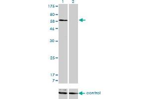 Western Blotting (WB) image for anti-Sorting Nexin 1 (SNX1) (AA 166-276) antibody (ABIN598935) (Sorting Nexin 1 抗体  (AA 166-276))