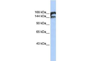 WB Suggested Anti-TOP2B Antibody Titration:  0. (TOP2B 抗体  (Middle Region))