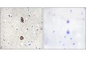 Immunohistochemistry analysis of paraffin-embedded human brain, using IGFBP-3 (Phospho-Ser183) Antibody. (IGFBP3 抗体  (pSer183))