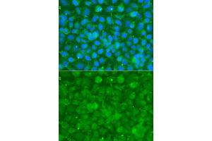 Immunofluorescence (IF) image for anti-serpin Peptidase Inhibitor, Clade A (Alpha-1 Antiproteinase, Antitrypsin), Member 3 (SERPINA3) (AA 24-423) antibody (ABIN6147571)