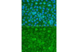 Immunofluorescence analysis of A549 cells using SERPINA3 antibody. (SERPINA3 抗体  (AA 24-423))