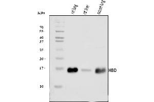 Western blot analysis of HBD using anti-HBD antibody (ABIN7599001).