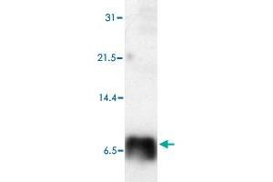 Western blot analysis of Human S100P polyclonal antibody  in HeLa cell lysate.