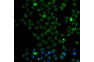 Immunofluorescence analysis of MCF-7 cells using LMO4 Polyclonal Antibody (LMO4 抗体)