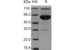 ESAM Protein (Fc Tag)