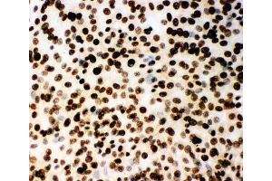 ICC testing of (m) NIH3T3 cells (MCM2 抗体  (AA 884-904))