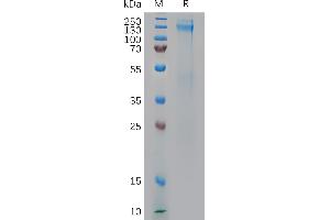 SDS-PAGE (SDS) image for Insulin-Like Growth Factor 1 Receptor (IGF1R) (AA 31-932) protein (His tag) (ABIN6964134)