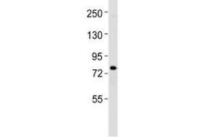 Western Blotting (WB) image for anti-Excision Repair Cross-Complementing Rodent Repair Deficiency, Complementation Group 2 (ERCC2) (C-Term) antibody (ABIN3030897)