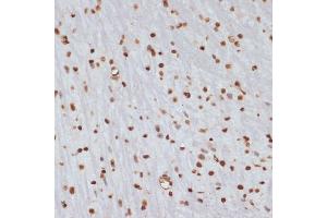 Immunohistochemistry of paraffin-embedded mouse brain using Phospho-Chk1-S280 antibody (ABIN3019445, ABIN3019446, ABIN3019447 and ABIN6225372) at dilution of 1:100 (40x lens). (CHEK1 抗体  (pSer280))