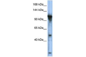 WB Suggested Anti-GTF3C2 Antibody Titration:  0. (GTF3C2 抗体  (Middle Region))