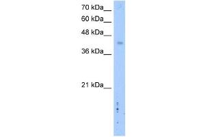 WB Suggested Anti-LRRC2 Antibody Titration: 2. (LRRC2 抗体  (C-Term))