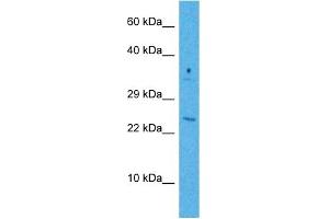 Western Blotting (WB) image for anti-Growth Arrest and DNA-Damage-Inducible, beta (GADD45B) (Middle Region) antibody (ABIN2783334)