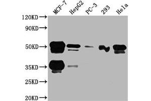 Western Blot Positive WB detected in: MCF-7 whole cell lysate, HepG2 whole cell lysate, PC-3 whole cell lysate, 293 whole cell lysate, Hela whole cell lysate All lanes: FOXA1 antibody at 1:2000 Secondary Goat polyclonal to rabbit IgG at 1/50000 dilution Predicted band size: 50, 46 kDa Observed band size: 50 kDa