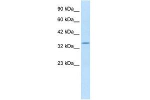 KCNAB2 antibody used at 1.
