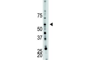 Western Blotting (WB) image for anti-6-phosphofructo-2-Kinase/fructose-2,6-Biphosphatase 4 (PFKFB4) antibody (ABIN3003725) (PFKFB4 抗体)