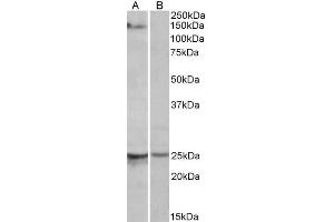 ABIN5937391 (1 µg/ml) staining of Mouse Heart lysate (35 µg protein in RIPA buffer) with (B) and without (A) blocking with the immunising peptide. (RBM20 抗体  (AA 717-727))