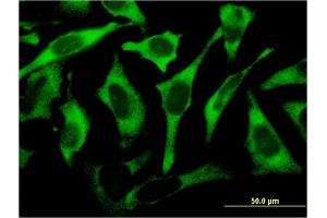 Immunofluorescence of monoclonal antibody to RPL17 on HeLa cell. (RPL17 抗体  (AA 1-184))