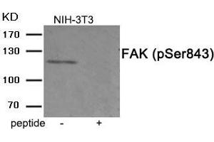 Western blot analysis of extracts from 3T3 cells treated with PMA using Phospho-FAK (Ser843) antibody. (FAK 抗体  (pSer843))
