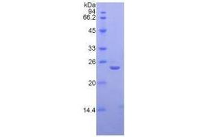 SDS-PAGE analysis of Human SIGLEC12 Protein. (SIGLEC12 蛋白)