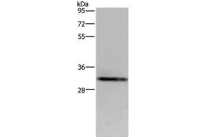 Western Blot analysis of OP9 cell using CD242 Polyclonal Antibody at dilution of 1:500 (ICAM4 抗体)