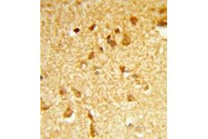 Formalin-fixed and paraffin-embedded human brain tissue reacted with DDX17 Antibody (N-term) followed which was peroxidase-conjugated to the secondary antibody, followed by DAB staining. (DDX17 抗体  (N-Term))