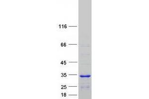 Validation with Western Blot