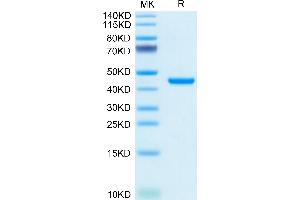 Mouse RETN on Tris-Bis PAGE under reduced condition. (Resistin Protein (RETN) (AA 21-114) (Fc Tag))