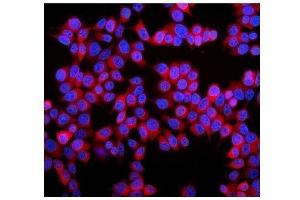 IF analysis of Stathmin 1 using anti-Stathmin 1 antibody (ABIN3043301). (Stathmin 1 抗体  (N-Term))