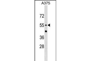 CNDP1 Antibody (Center) (ABIN1537860 and ABIN2849250) western blot analysis in  cell line lysates (35 μg/lane). (CNDP1 抗体  (AA 142-170))