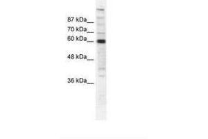 Image no. 1 for anti-Polymerase (RNA) II (DNA Directed) Polypeptide B, 140kDa (POLR2B) (AA 119-168) antibody (ABIN202976) (POLR2B 抗体  (AA 119-168))