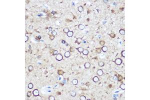 Immunohistochemistry of paraffin-embedded Rat brain using EY Rabbit pAb (ABIN6135167, ABIN6140386, ABIN6225031 and ABIN6225033) at dilution of 1:100 (40x lens). (EYA1 抗体  (AA 100-250))