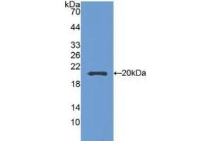 Western Blotting (WB) image for anti-Sema Domain, Seven Thrombospondin Repeats (Type 1 and Type 1-Like), Transmembrane Domain (TM) and Short Cytoplasmic Domain, (Semaphorin) 5B (SEMA5B) (AA 836-1013) antibody (ABIN7437377)