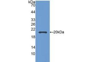 Detection of Recombinant SEMA5B, Mouse using Polyclonal Antibody to Semaphorin 5B (SEMA5B) (SEMA5B 抗体  (AA 836-1013))