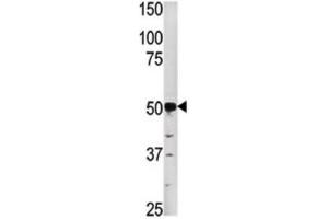 Western Blotting (WB) image for anti-Phosphoglycerate Kinase 2 (PGK2) antibody (ABIN3003022) (PGK2 抗体)