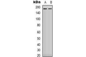 Western blot analysis of HER2 expression in MDA (A), SKOV3 (B) whole cell lysates. (ErbB2/Her2 抗体  (C-Term))