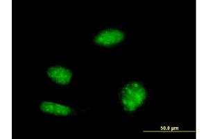 Immunofluorescence (IF) image for anti-KH-Type Splicing Regulatory Protein (KHSRP) (AA 151-239) antibody (ABIN522039)